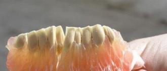 Какие полезные для зубов продукты включить в рацион?