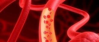 How to clean blood vessels at home: make the work of your heart easier